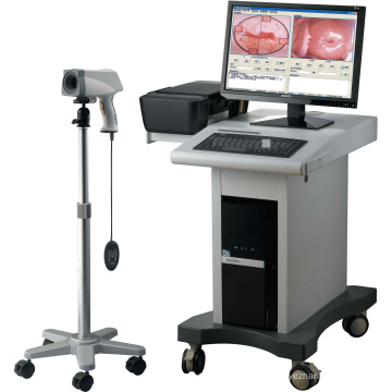 Medical Equipment Gynecological Products Digital Colposcope Imaging System